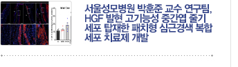 [CMC 세포치료 연구 동향] 서울성모병원 박훈준 교수 연구팀, HGF 발현 고기능성 중간엽 줄기세포 탑재한 패치형 심근경색 복합세포 치료제 개발 / 자세히보기