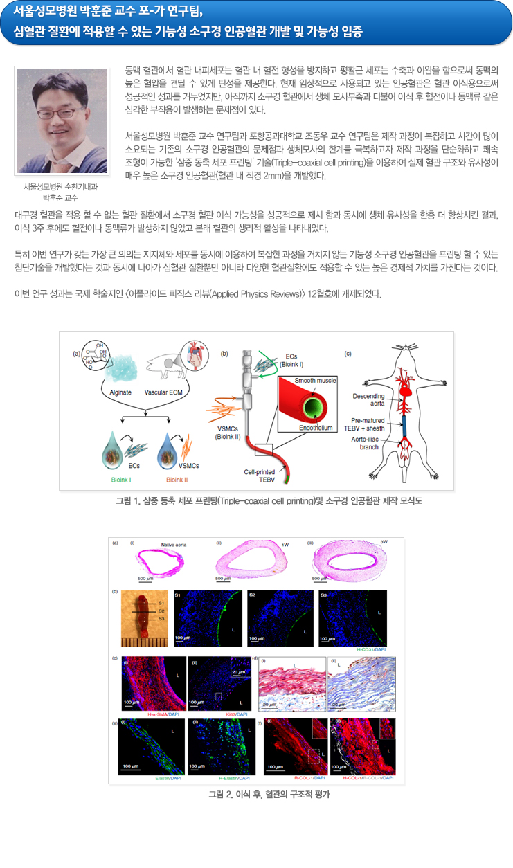 하단참조