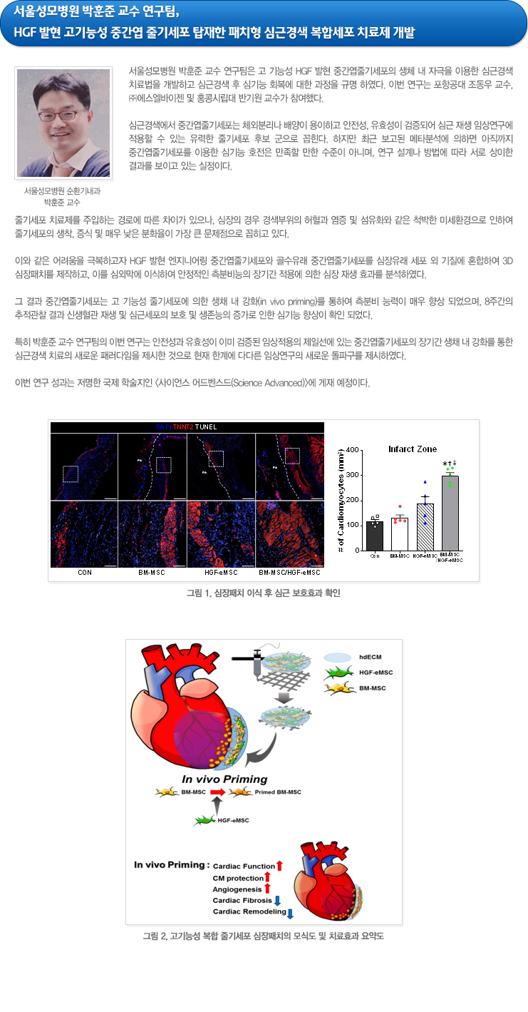 하단참조